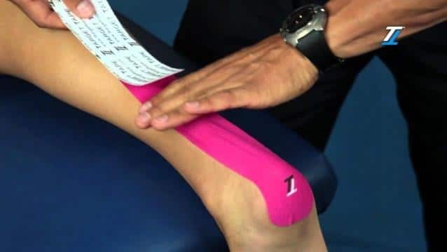 LA RIABILITAZIONE PROPRIOCETTIVA DOPO RICOSTRUZIONE DEL TENDINE D’ACHILLE