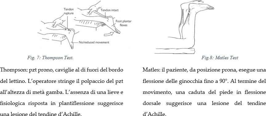 diagnosi della rottura del tendine d'achille