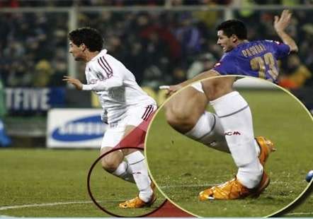 distorsione di caviglia