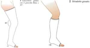 rottura del tendine d'achille stivaletto gessato