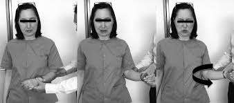 la-capsulite-adesiva-distention-test