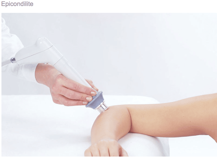 epicondilite