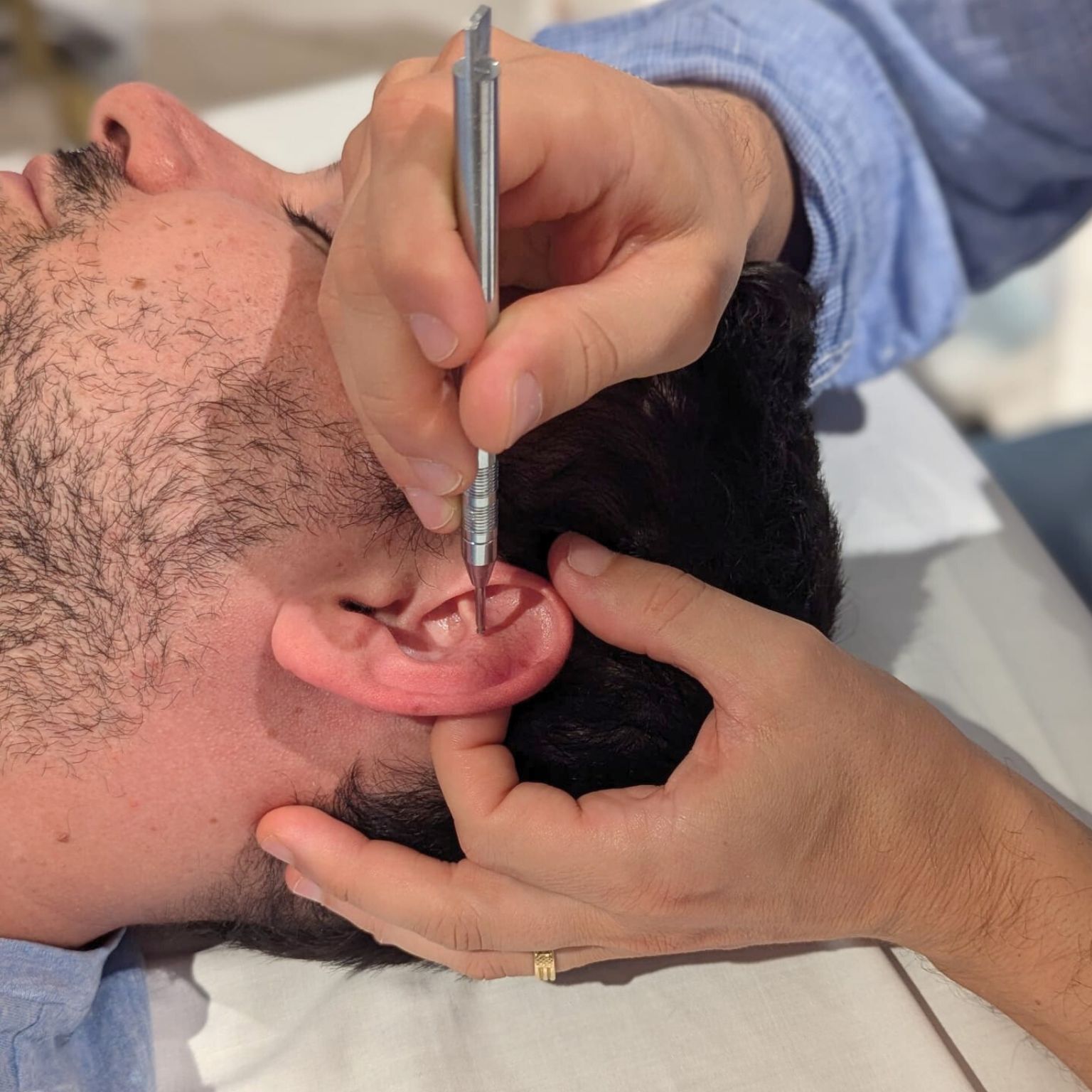 Auricoloterapia pratica in aula con i fisioterapisti